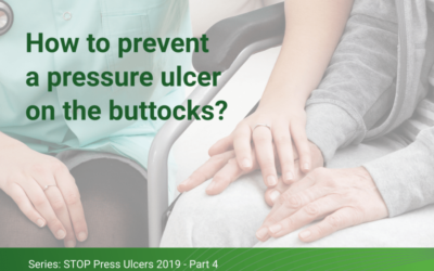 How to prevent pressure ulcers on the buttocks?