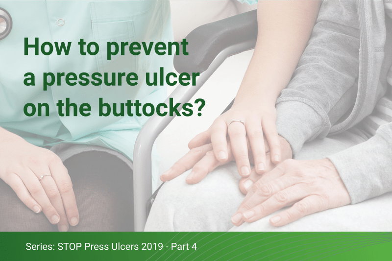 How to prevent pressure ulcers on the buttocks?